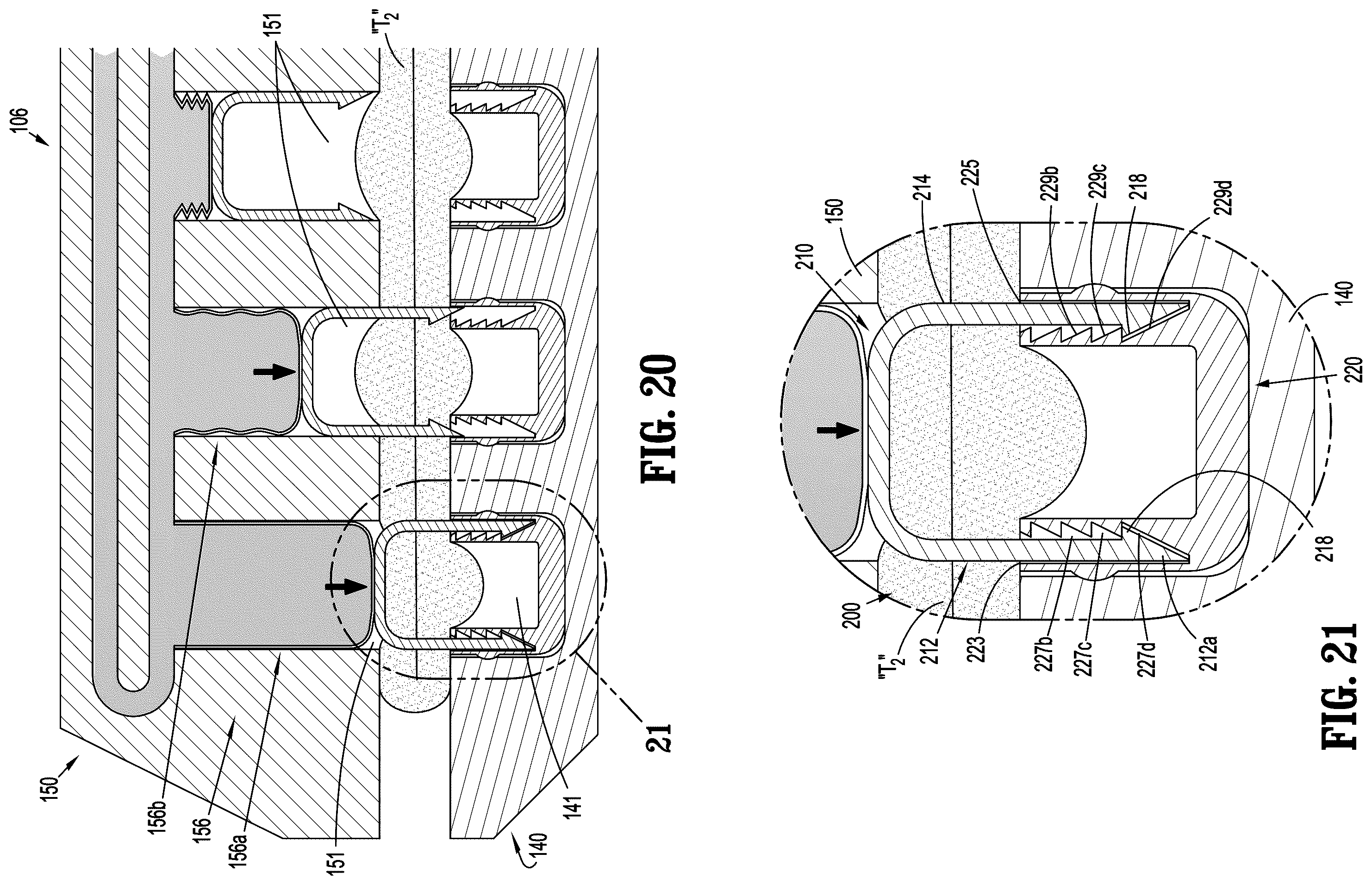 Patent US12137905 Figure 11 – Gas-powered continuous feed surgical fastening device