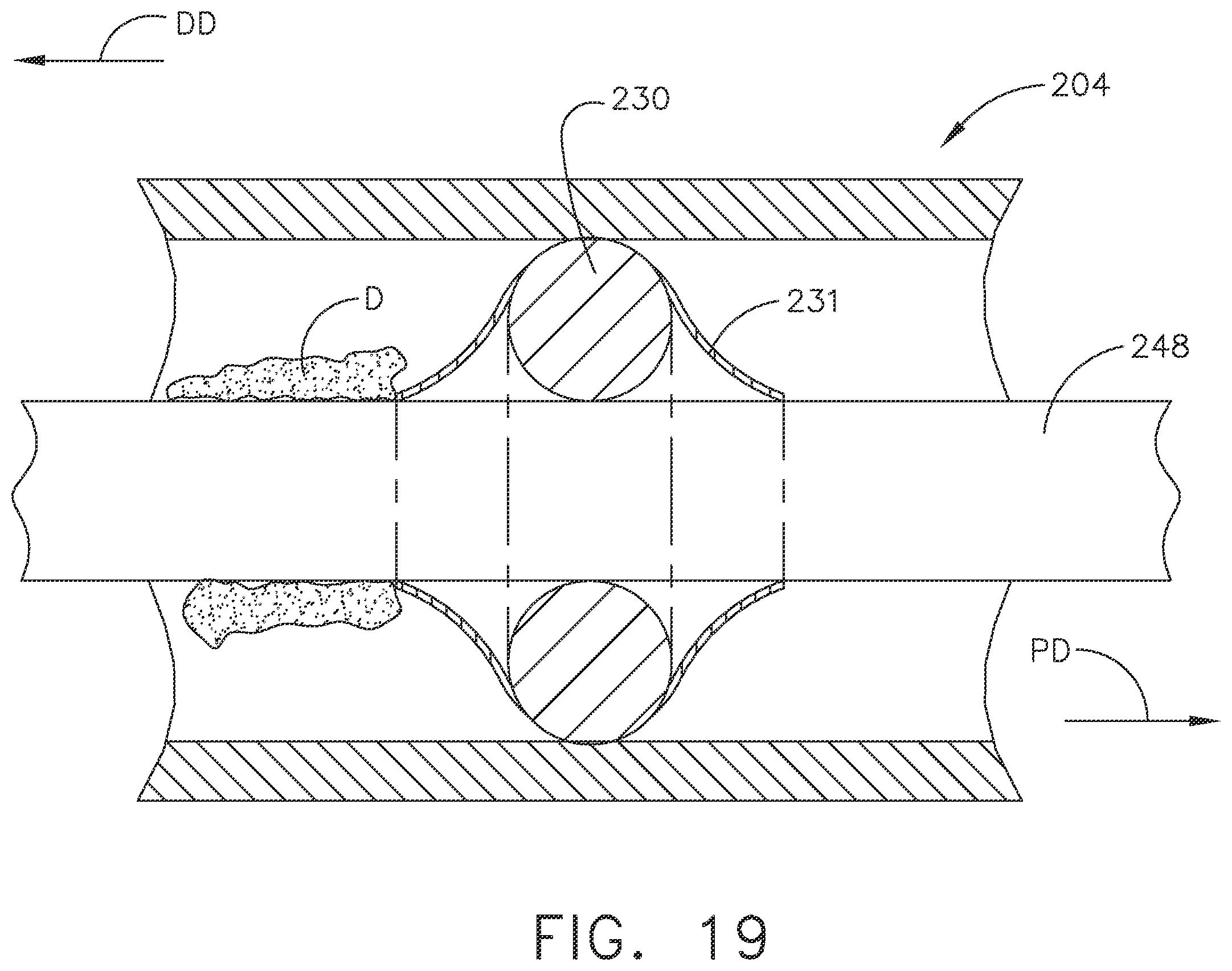 Patent US12137906 Figure 17 – Surgical systems comprising a control circuit