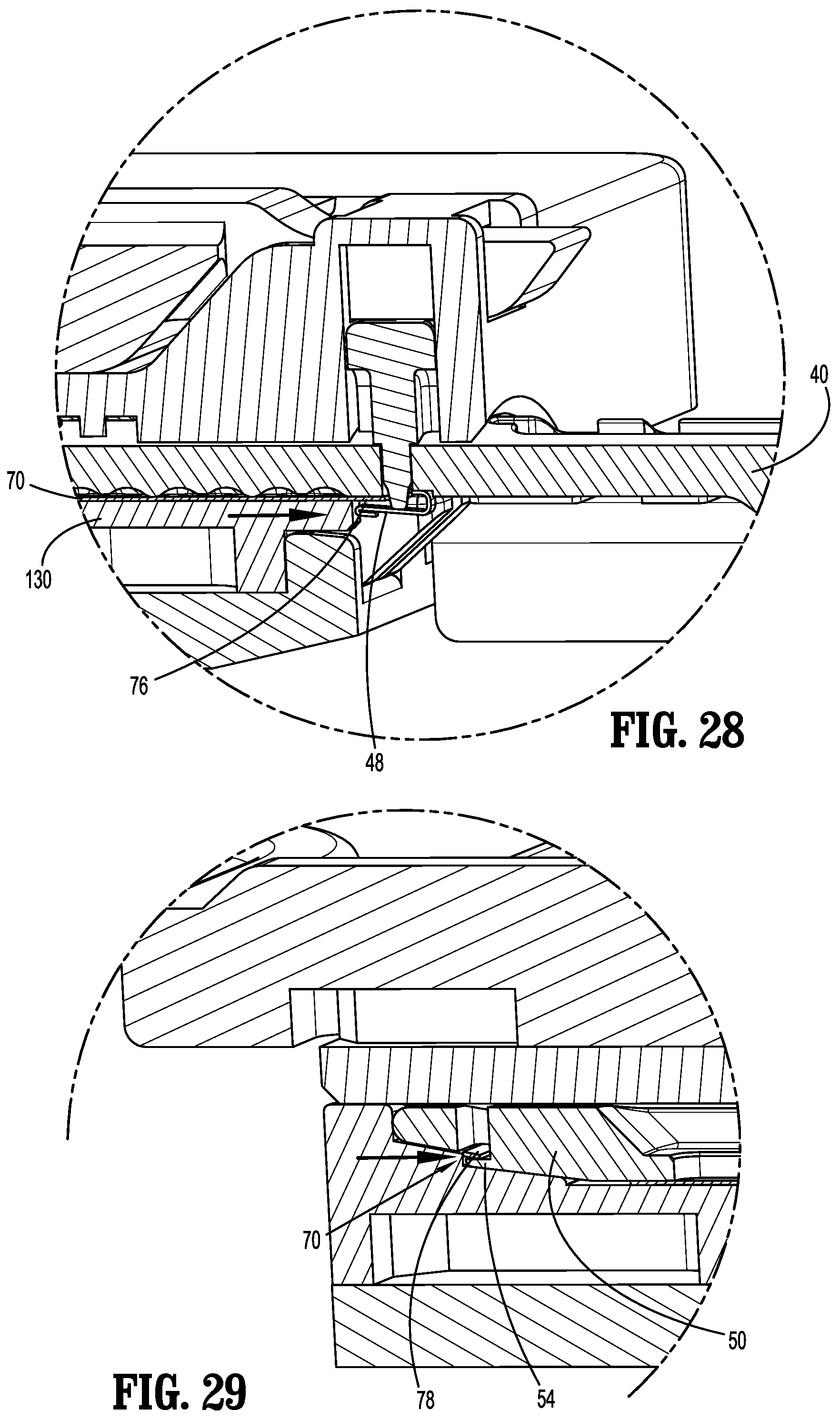 Patent US12137908 Figure 19 – Anvil buttress loading system for surgical stapling apparatus