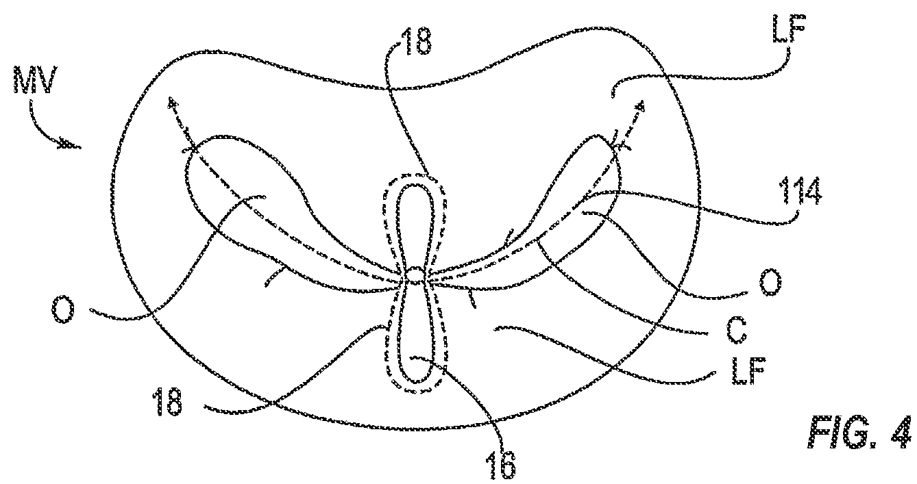 Patent US12137909 Figure 3 – Grasping for tissue repair
