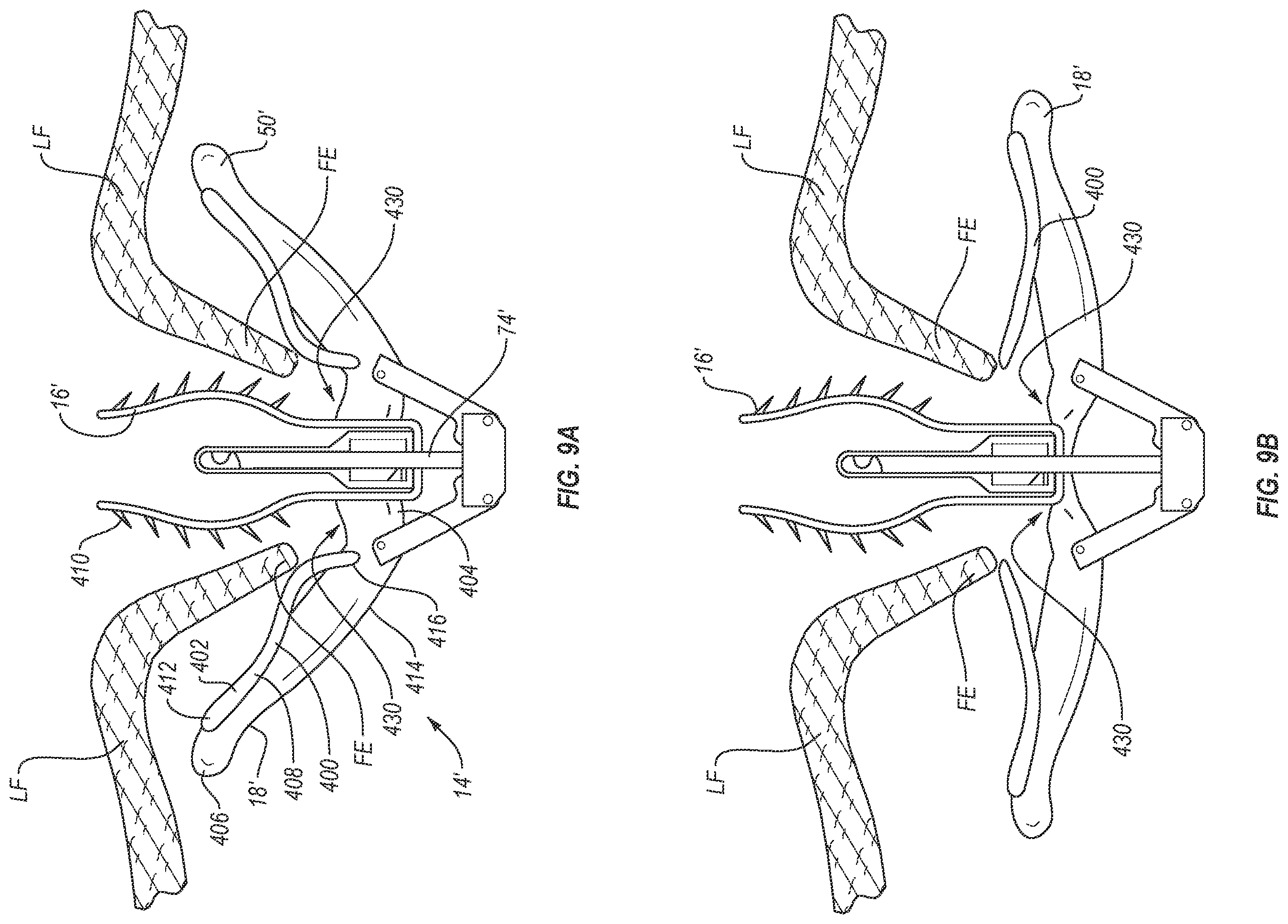 Patent US12137909 Figure 7 – Grasping for tissue repair