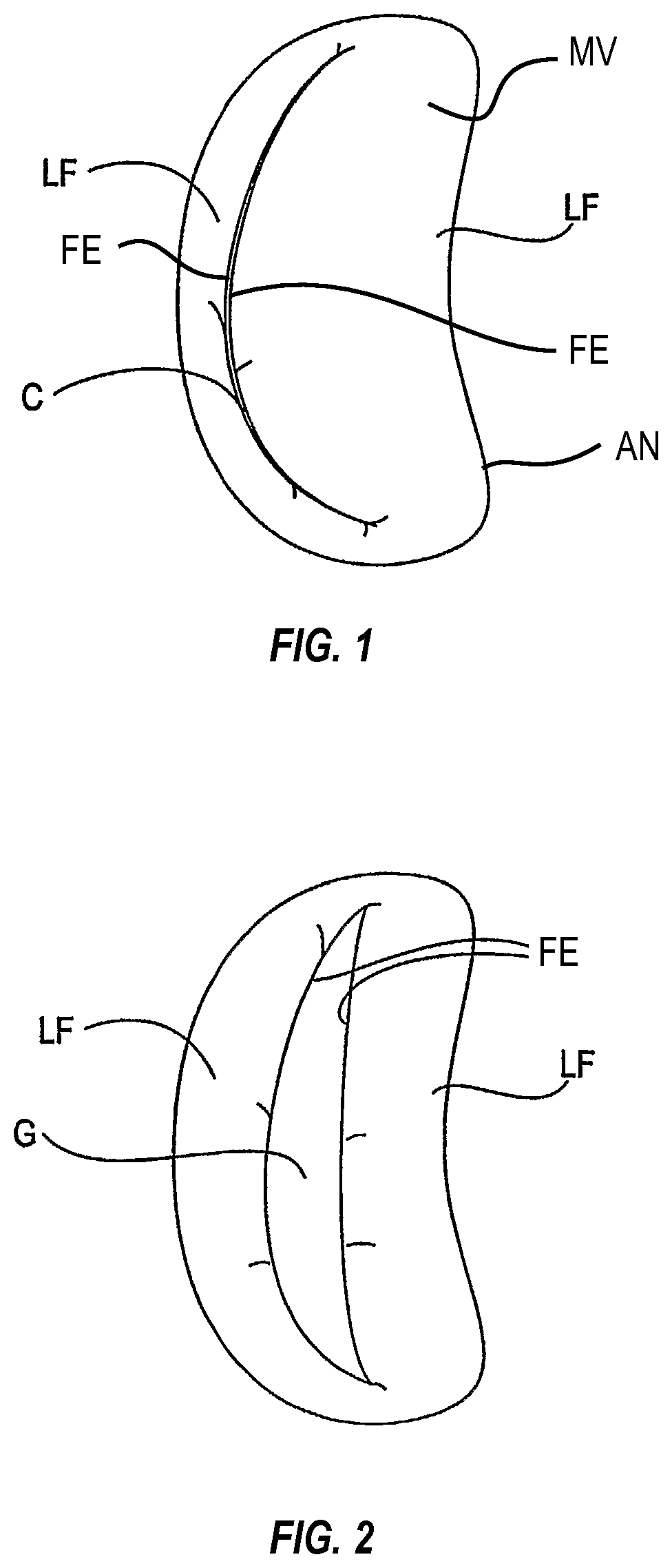 Patent US12137910 Figure 1 – Tissue grasping devices and related methods
