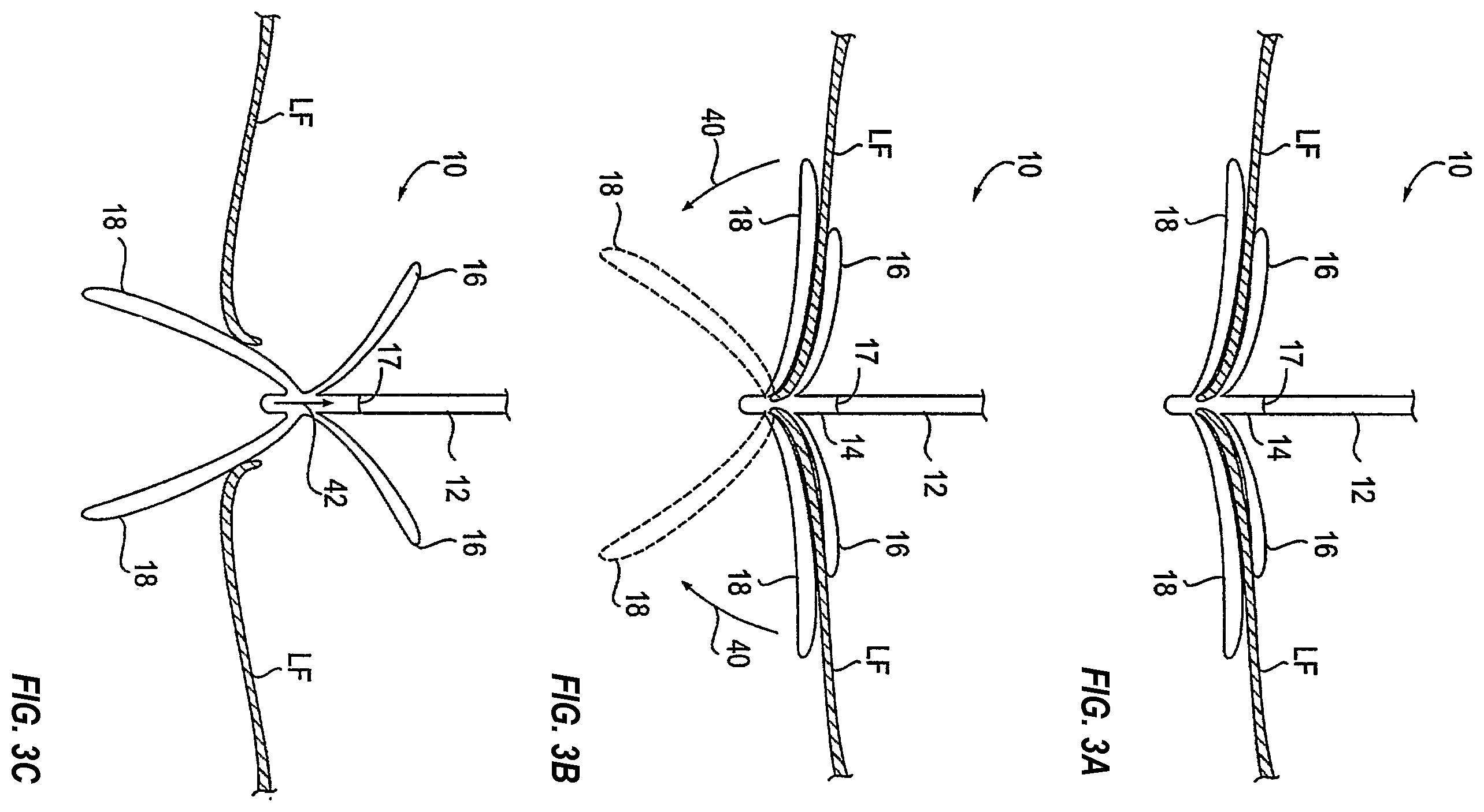 Patent US12137910 Figure 2 – Tissue grasping devices and related methods
