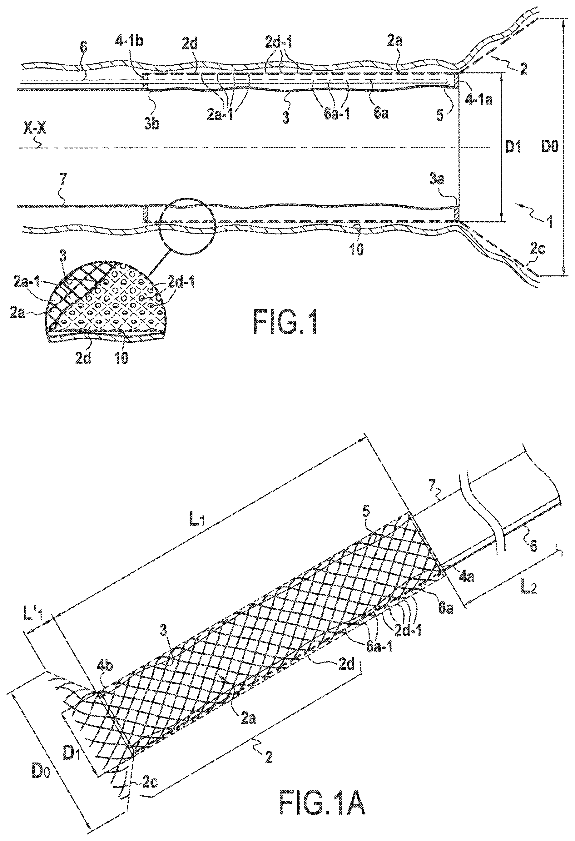 Patent US12137911 Figure 1 – Surgical device for controlled anchoring in the intestine