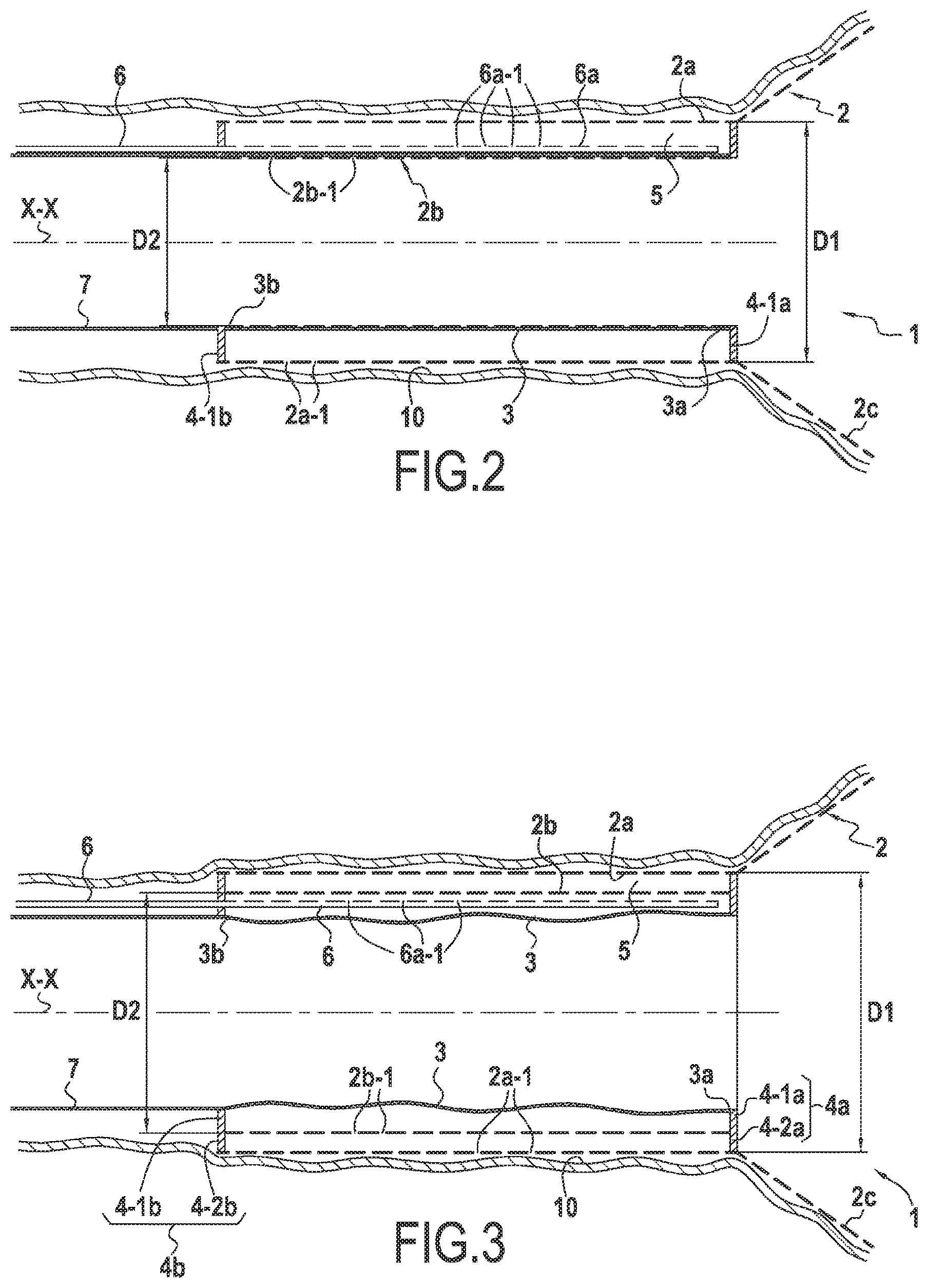 Patent US12137911 Figure 2 – Surgical device for controlled anchoring in the intestine