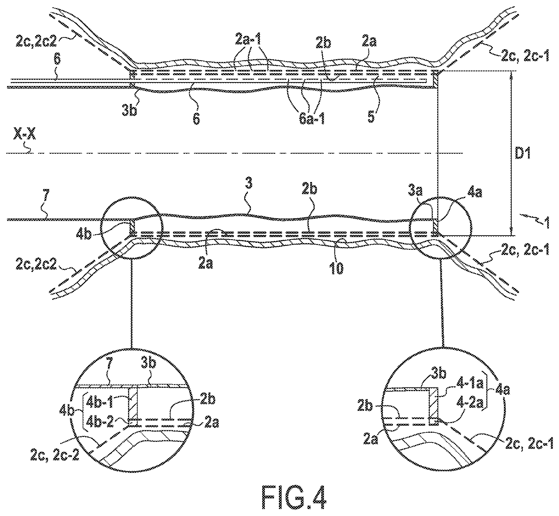 Patent US12137911 Figure 3 – Surgical device for controlled anchoring in the intestine