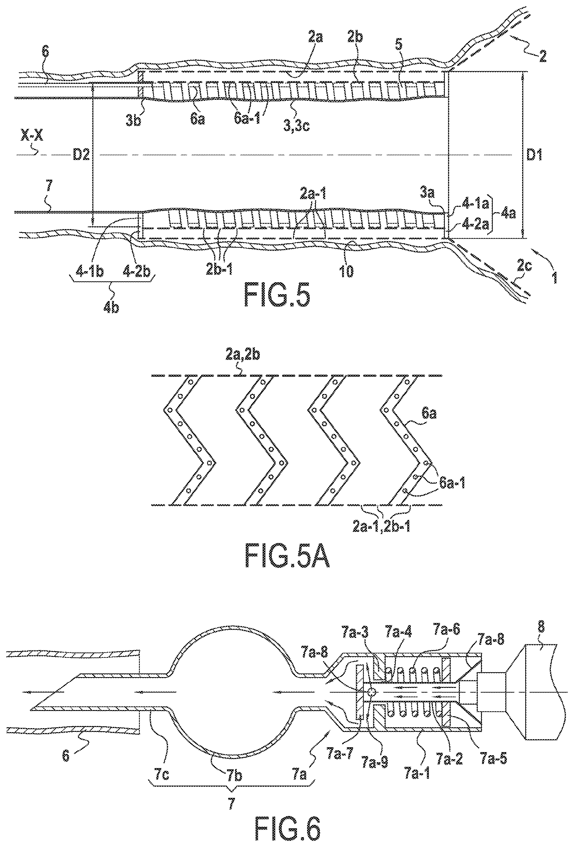 Patent US12137911 Figure 4 – Surgical device for controlled anchoring in the intestine