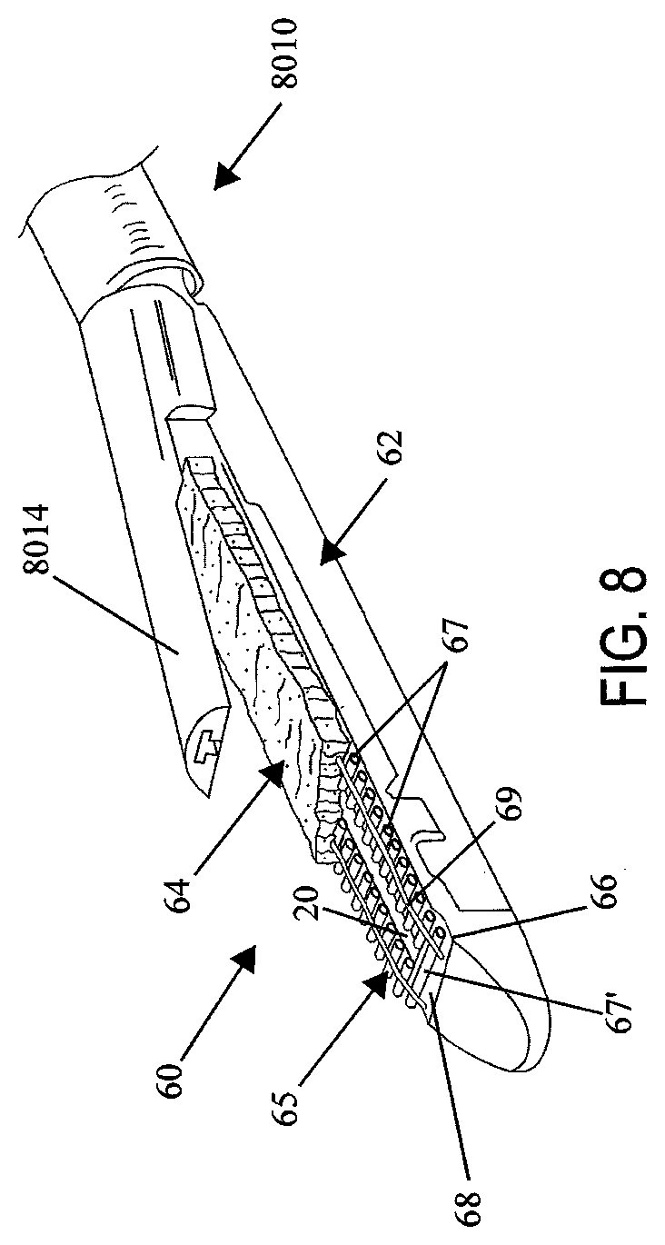 Patent US12137912 Figure 6 – Compressible adjunct with attachment regions