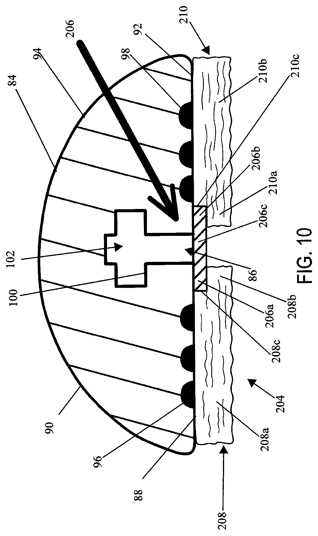 Patent US12137912 Figure 8 – Compressible adjunct with attachment regions