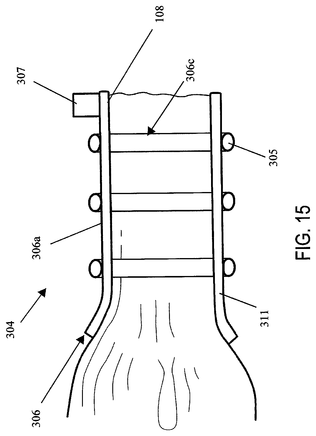 Patent US12137912 Figure 13 – Compressible adjunct with attachment regions