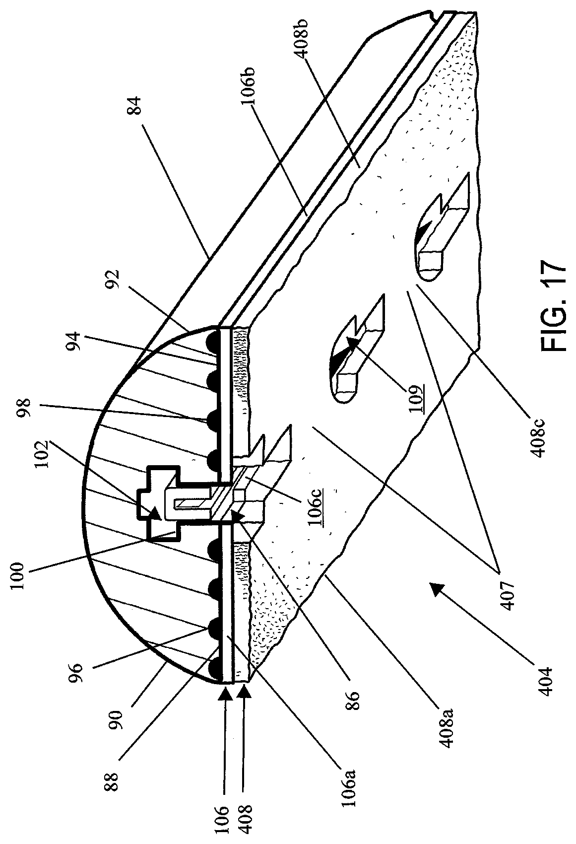 Patent US12137912 Figure 15 – Compressible adjunct with attachment regions