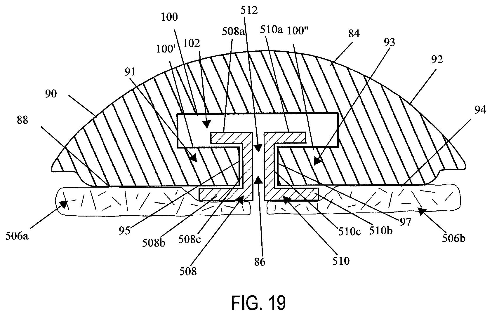 Patent US12137912 Figure 17 – Compressible adjunct with attachment regions