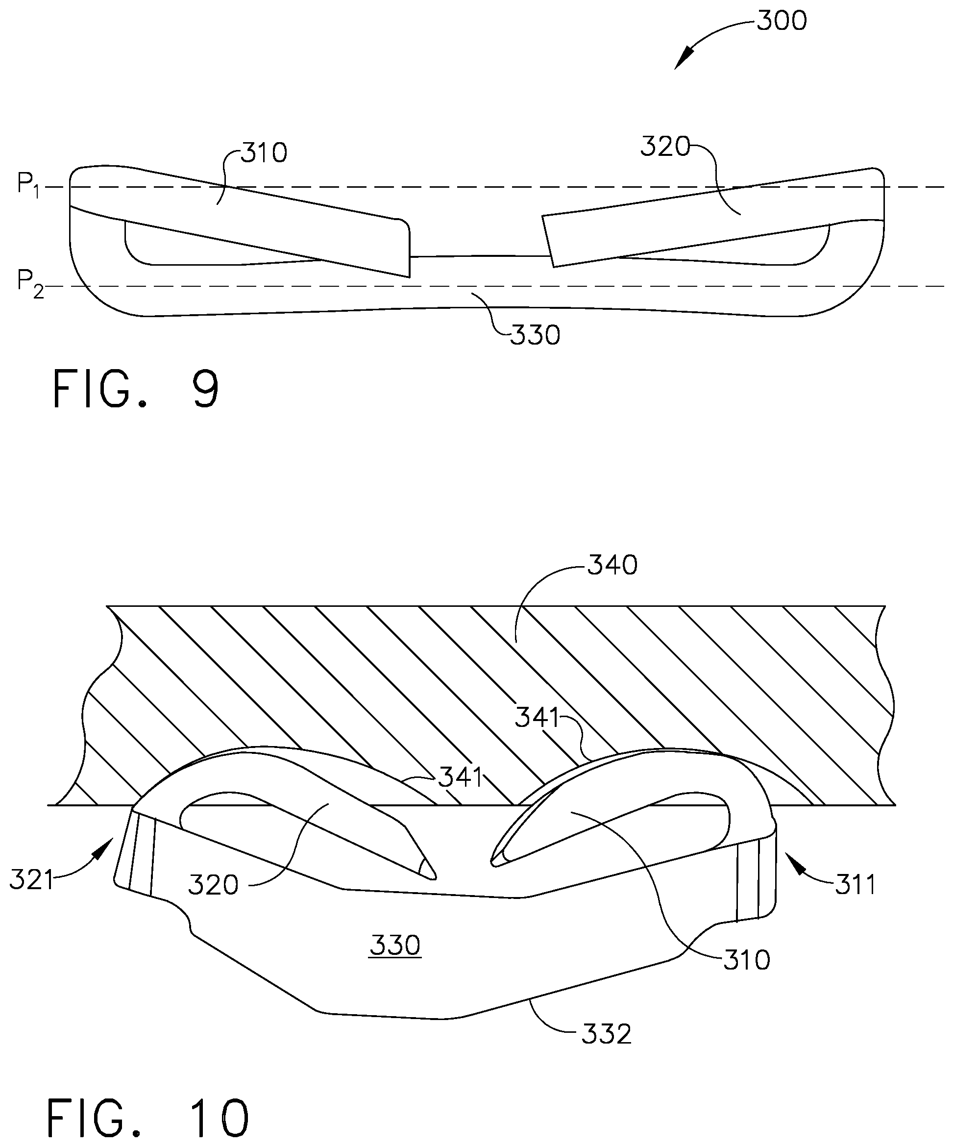 Patent US12137913 Figure 5 – Staple cartridge assembly comprising various tissue compression gaps and staple forming gaps