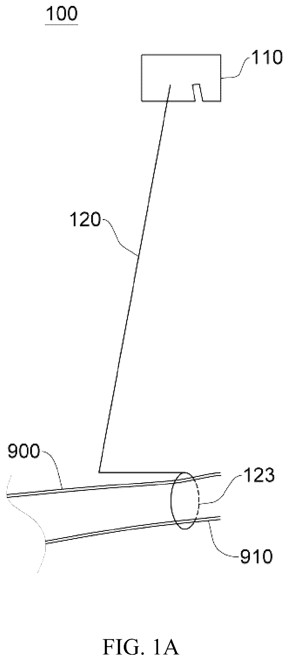 Patent US12137914 Figure 1 – Anastomosis set, anastomotic auxiliary and the method thereof