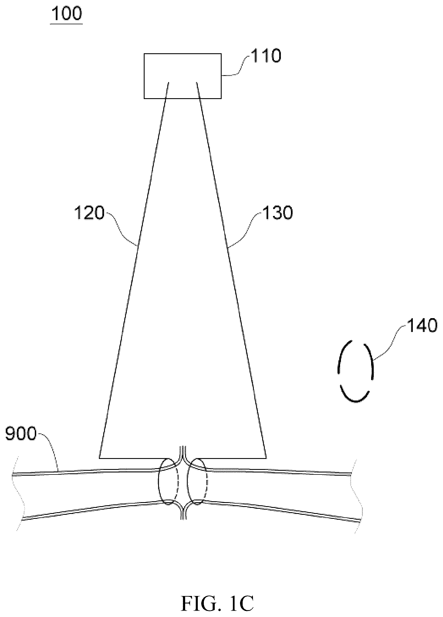 Patent US12137914 Figure 3 – Anastomosis set, anastomotic auxiliary and the method thereof