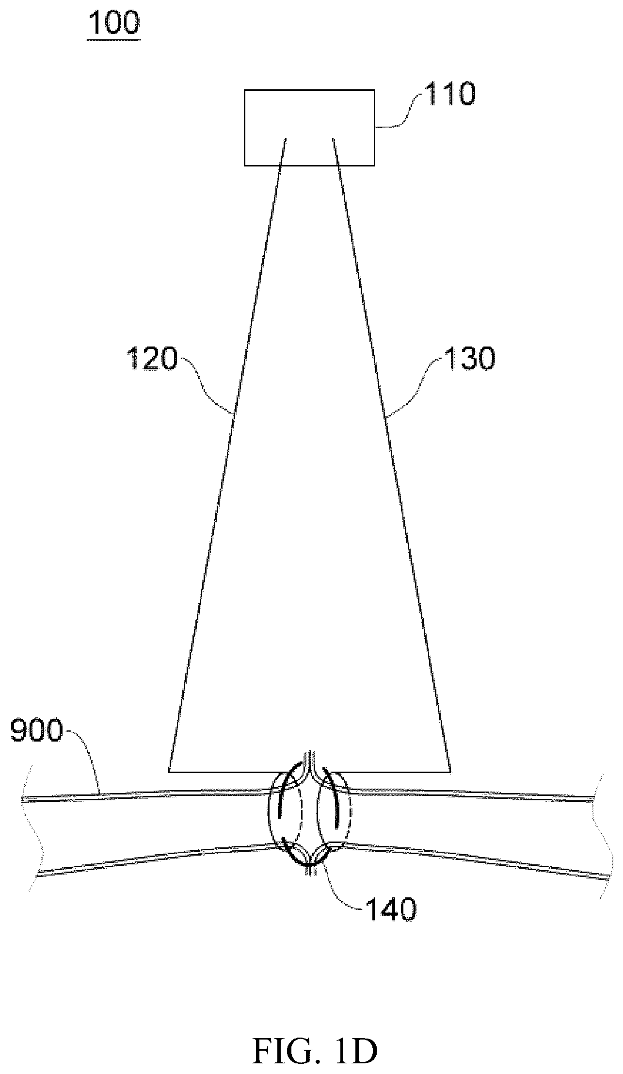 Patent US12137914 Figure 4 – Anastomosis set, anastomotic auxiliary and the method thereof