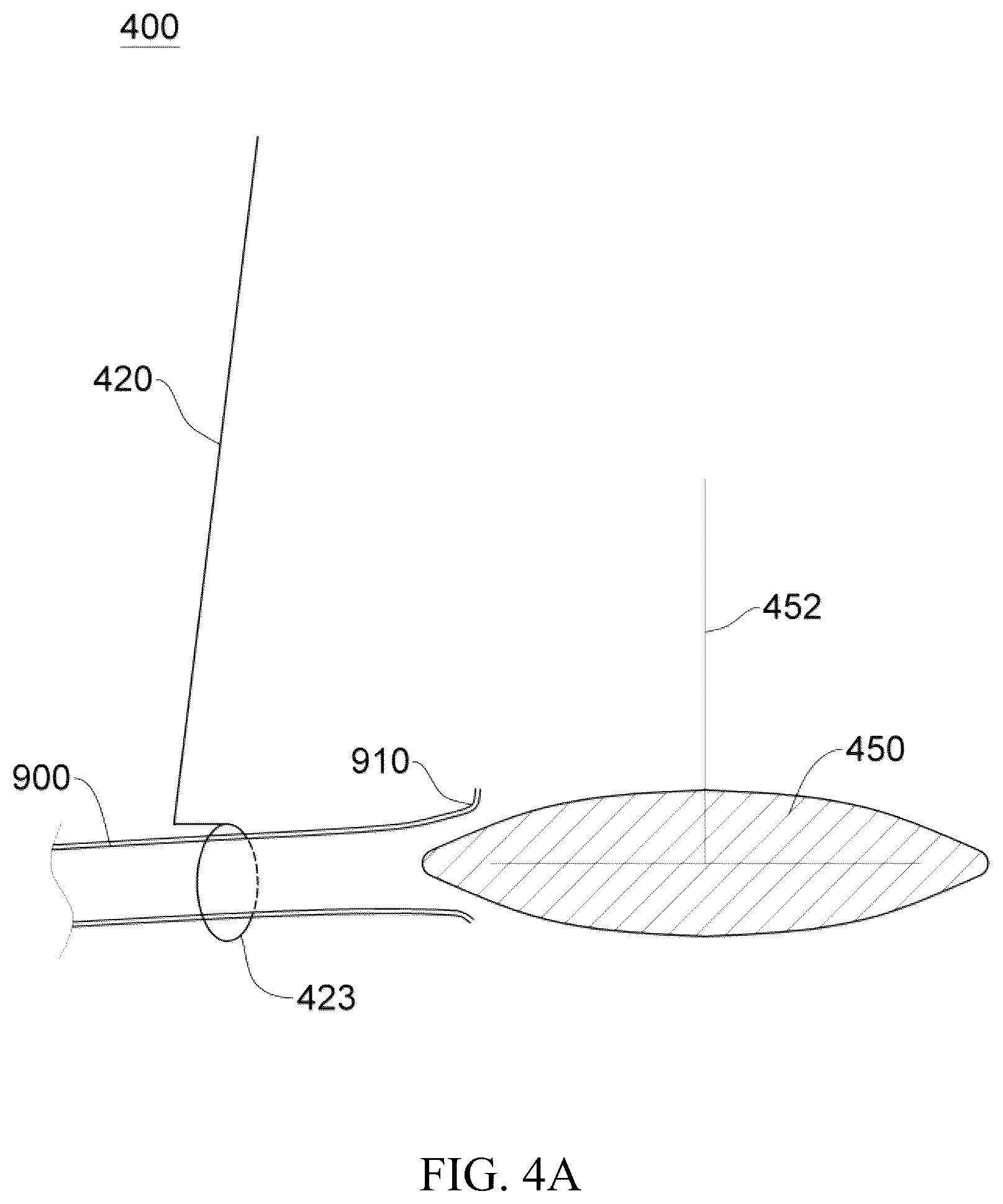 Patent US12137914 Figure 11 – Anastomosis set, anastomotic auxiliary and the method thereof