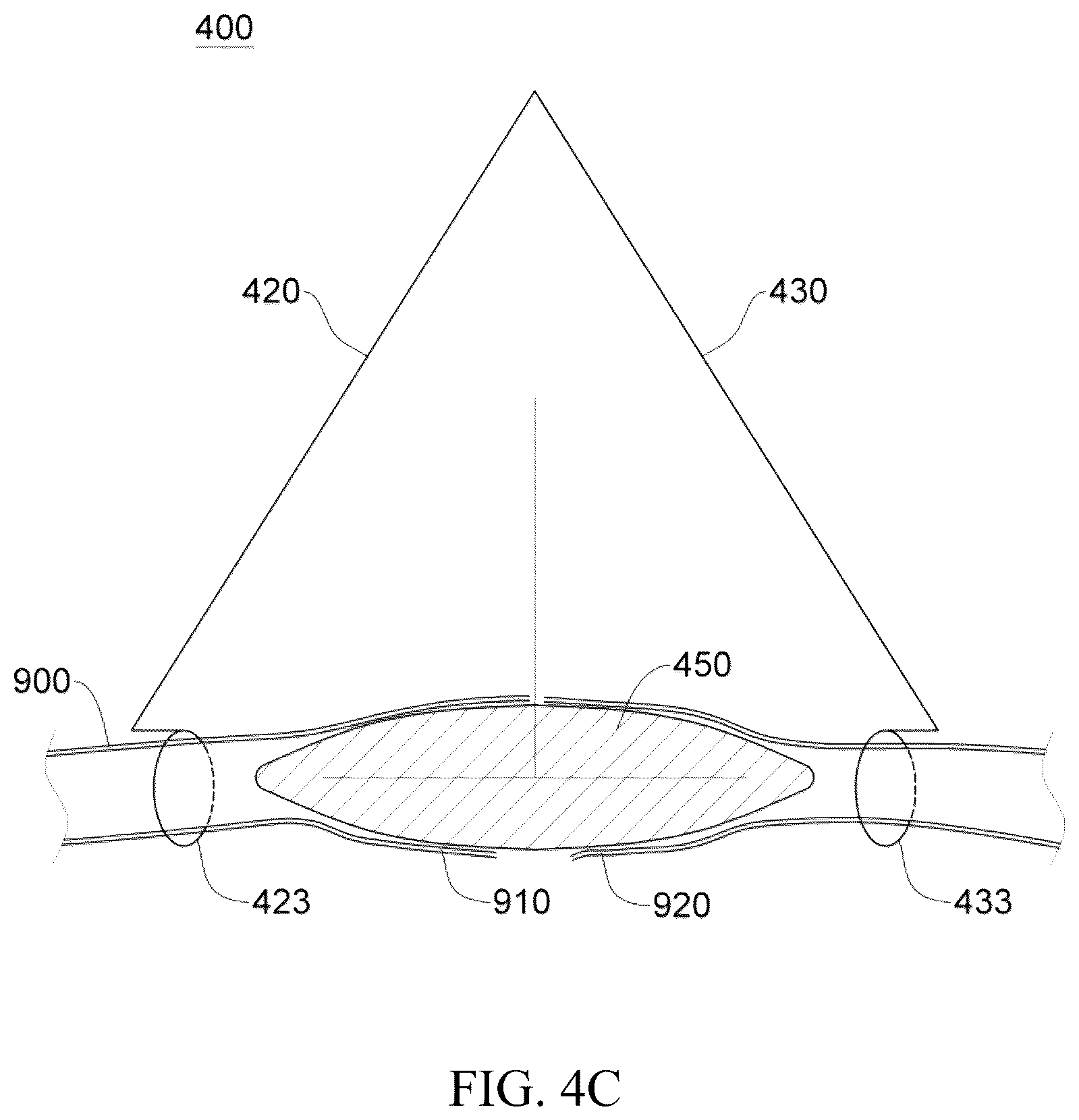 Patent US12137914 Figure 13 – Anastomosis set, anastomotic auxiliary and the method thereof