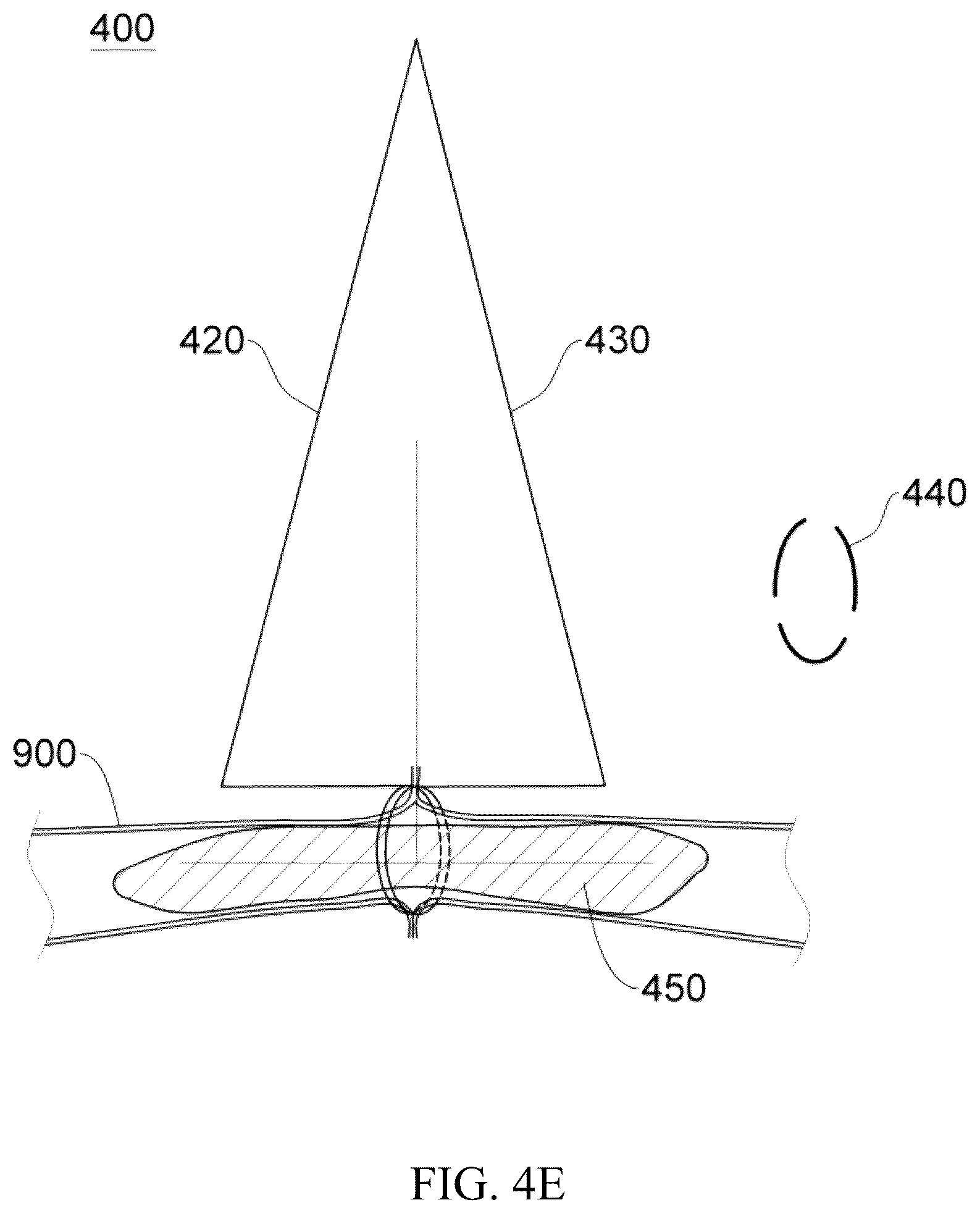Patent US12137914 Figure 15 – Anastomosis set, anastomotic auxiliary and the method thereof