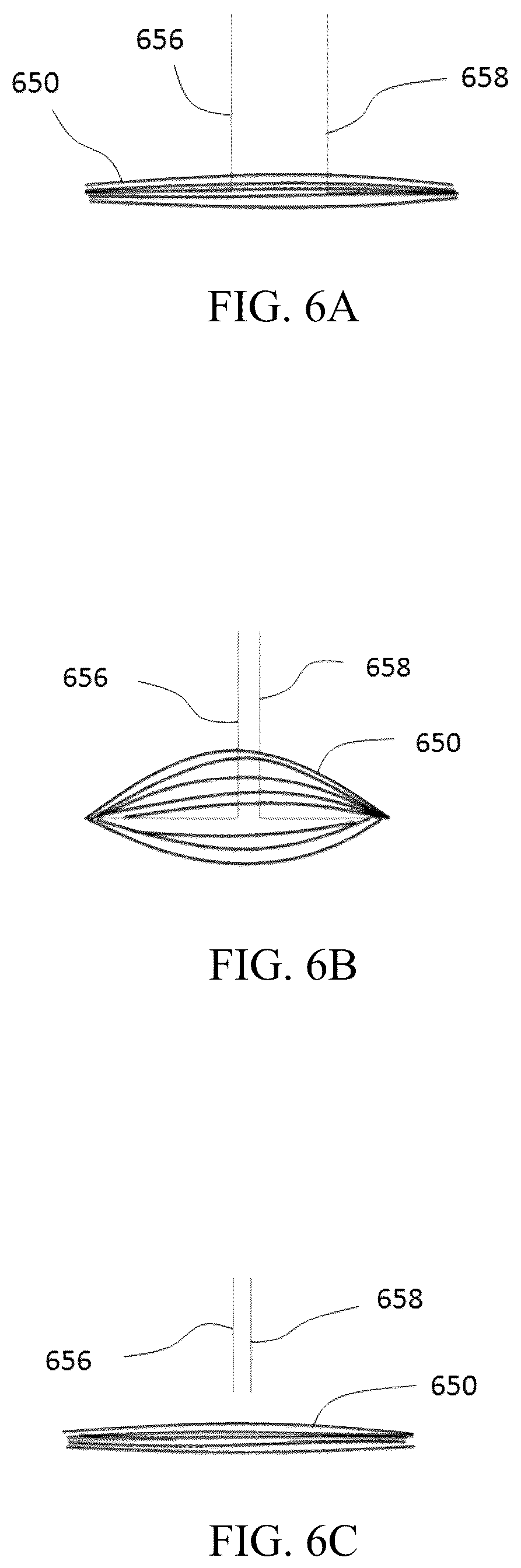 Patent US12137914 Figure 20 – Anastomosis set, anastomotic auxiliary and the method thereof