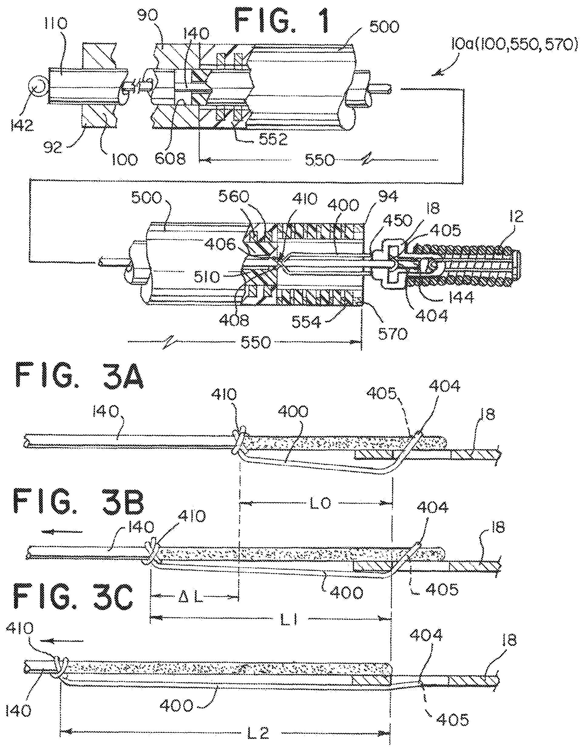 Patent US12137915 Figure 1 – Elongating wires for inhibiting premature implant detachment