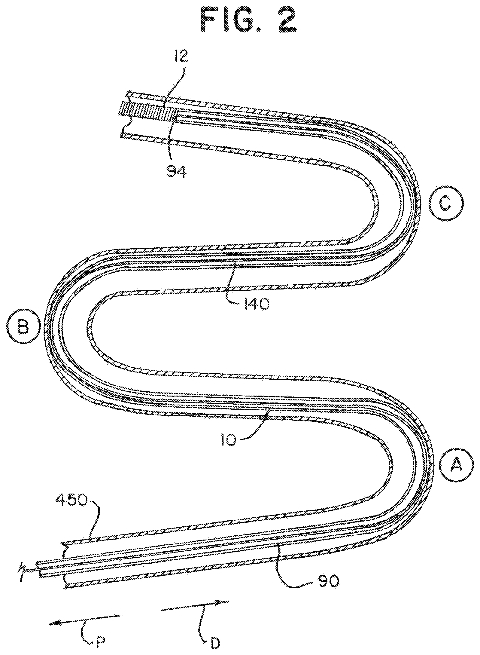 Patent US12137915 Figure 2 – Elongating wires for inhibiting premature implant detachment