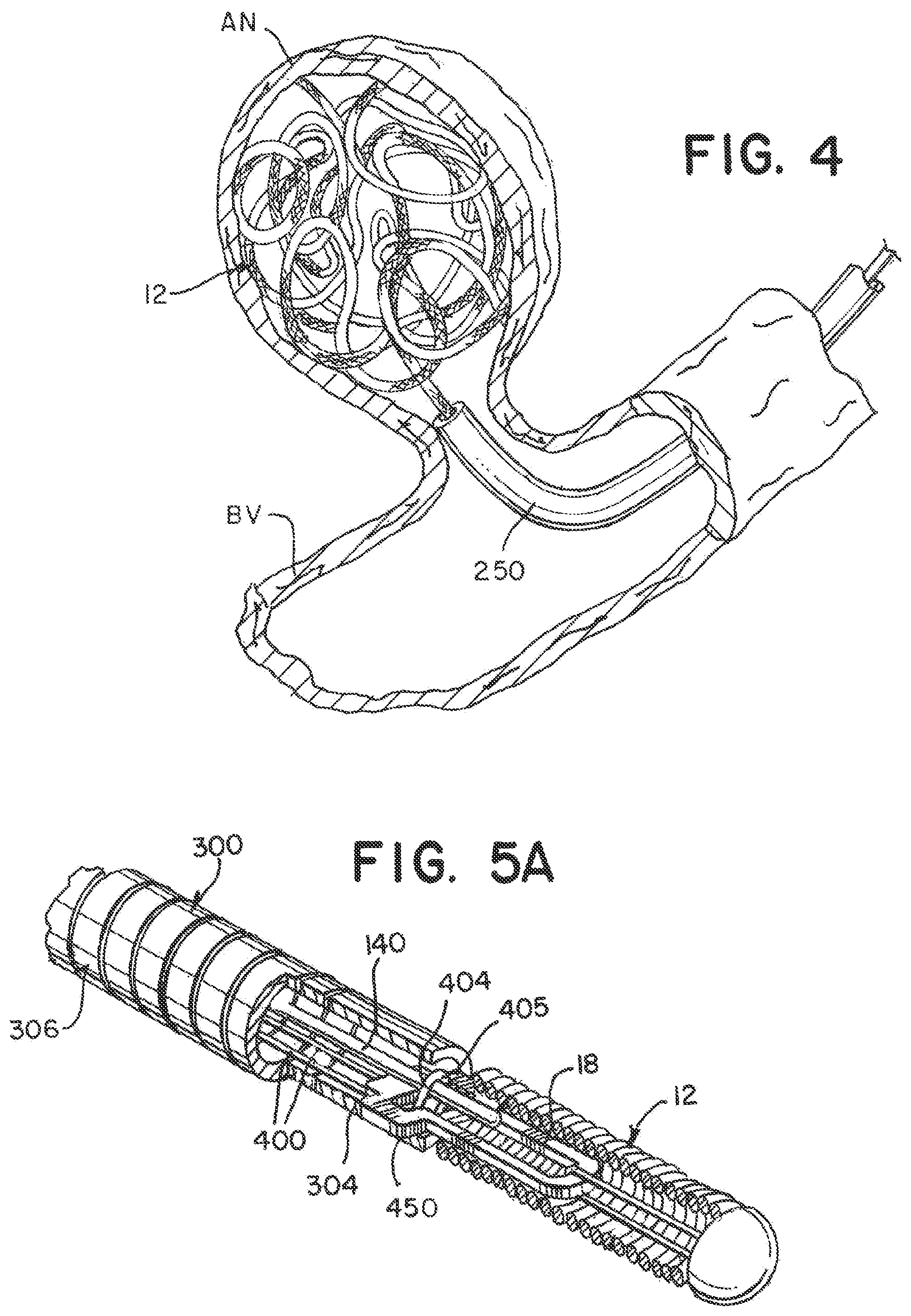 Patent US12137915 Figure 3 – Elongating wires for inhibiting premature implant detachment