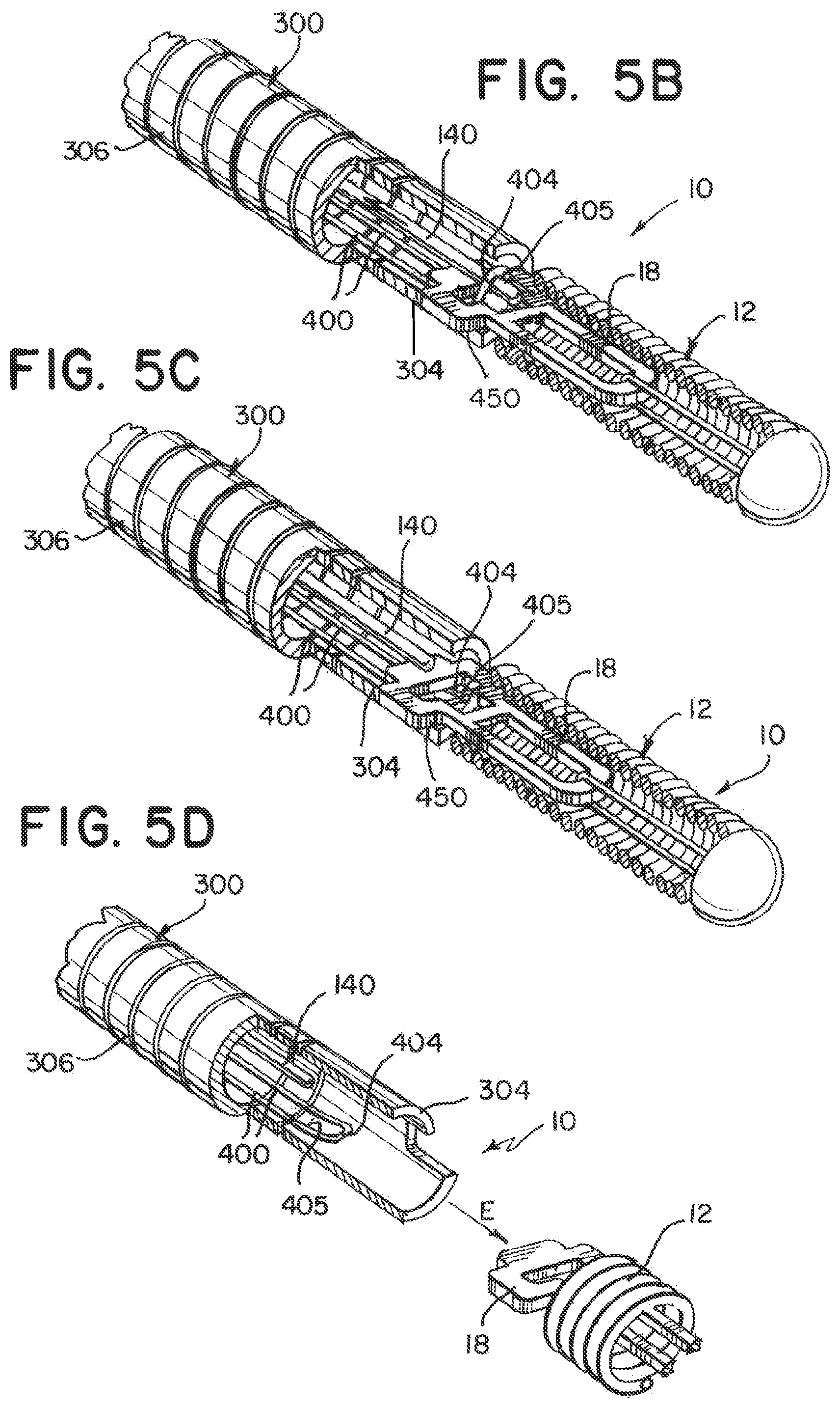Patent US12137915 Figure 4 – Elongating wires for inhibiting premature implant detachment