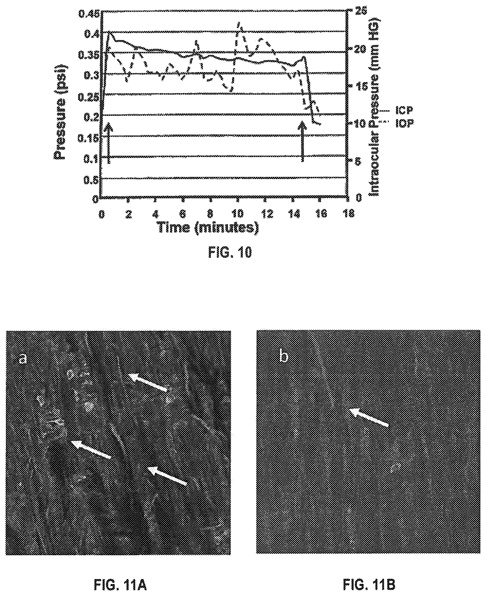 Patent US12137917 Figure 4 – Methods and devices to reduce the likelihood of injury from concussive or blast forces