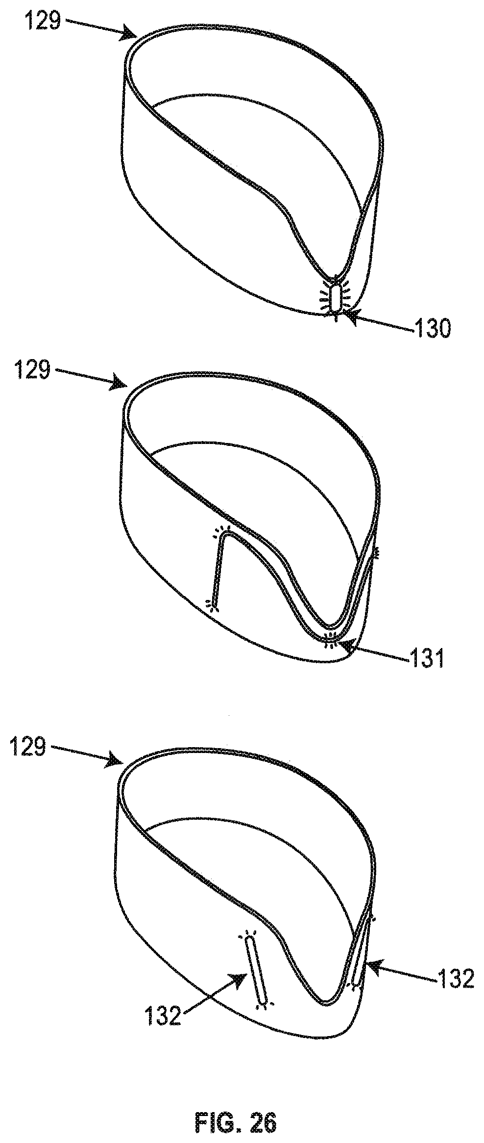 Patent US12137917 Figure 16 – Methods and devices to reduce the likelihood of injury from concussive or blast forces