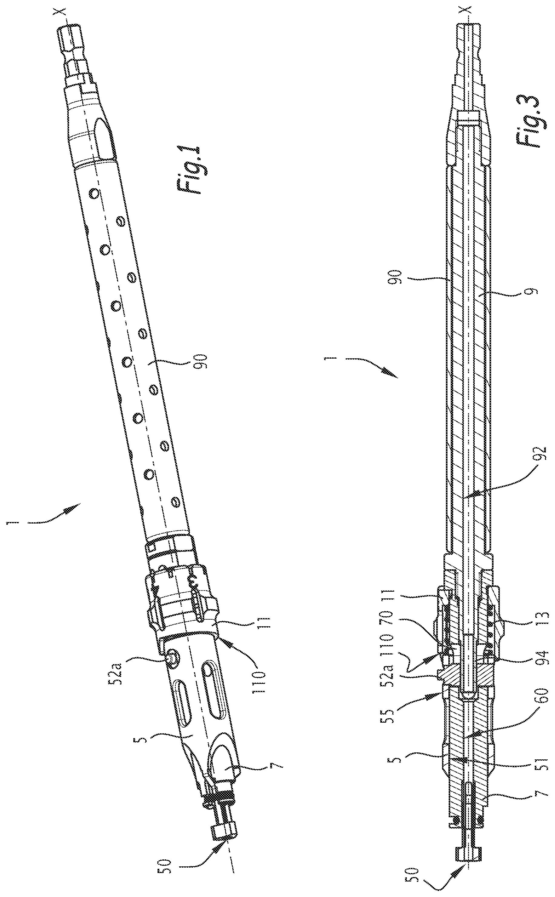 Patent US12137921 — Surgical bone preparation instrument and assembly comprising such an instrument — Figure 1