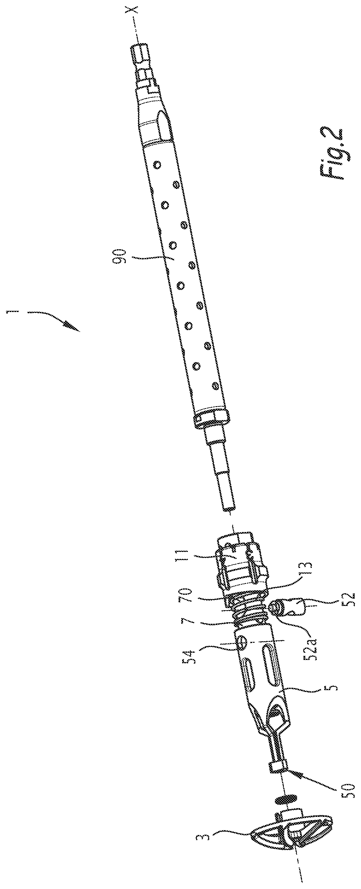 Patent US12137921 Figure 2 – Surgical bone preparation instrument and assembly comprising such an instrument