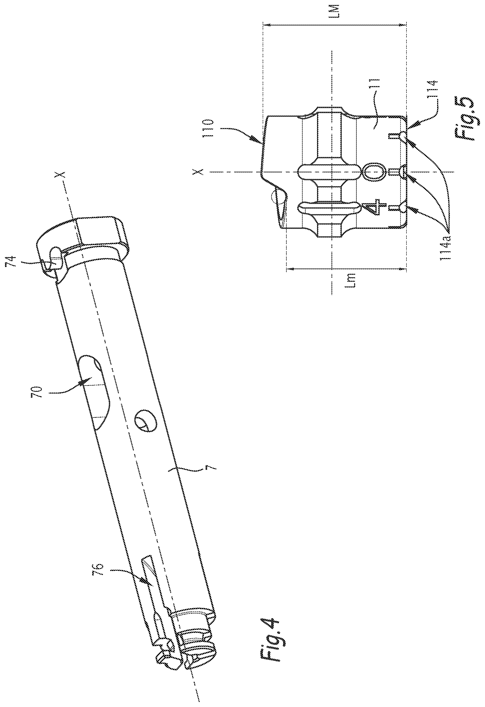 Patent US12137921 Figure 3 – Surgical bone preparation instrument and assembly comprising such an instrument