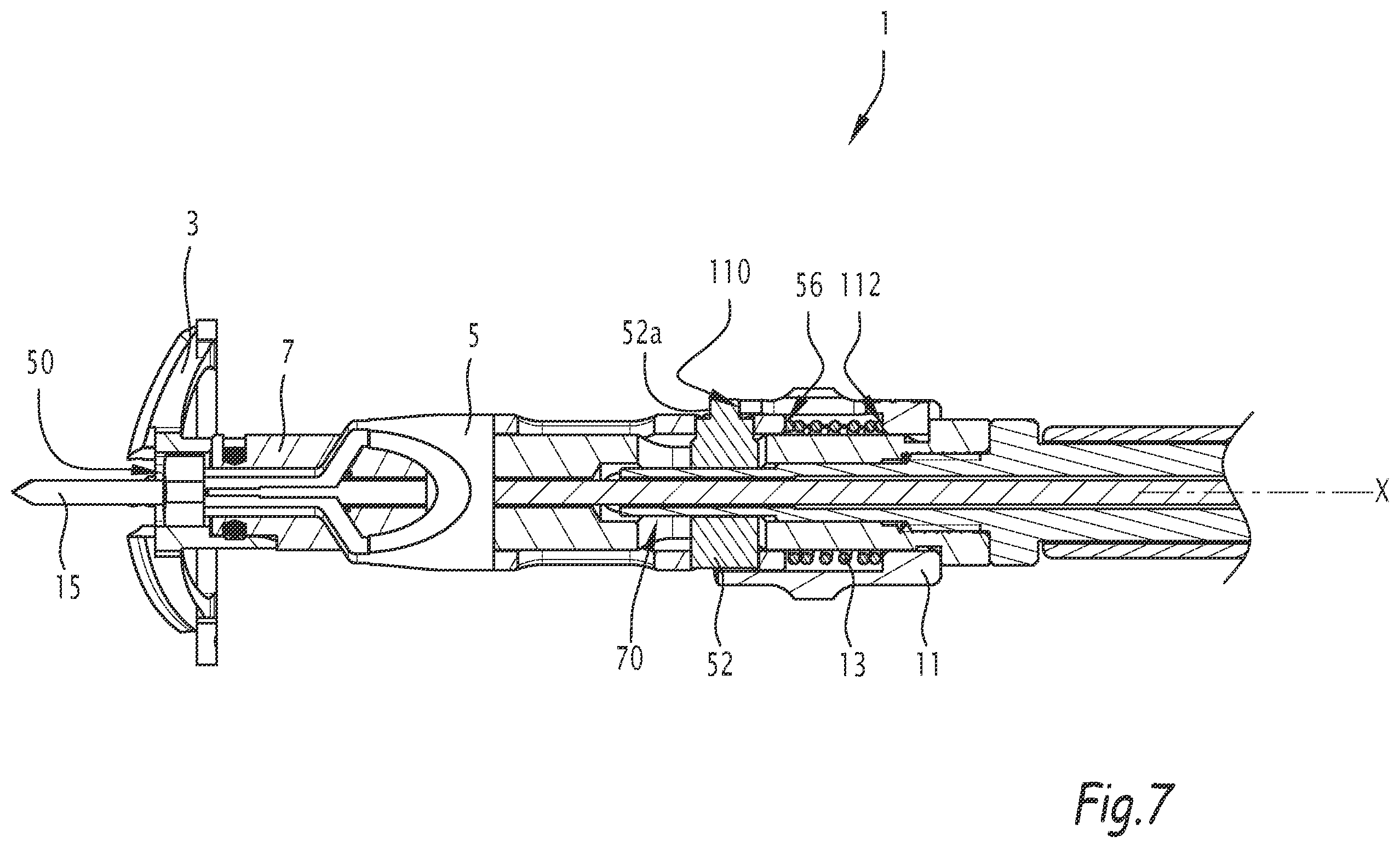 Patent US12137921 Figure 5 – Surgical bone preparation instrument and assembly comprising such an instrument