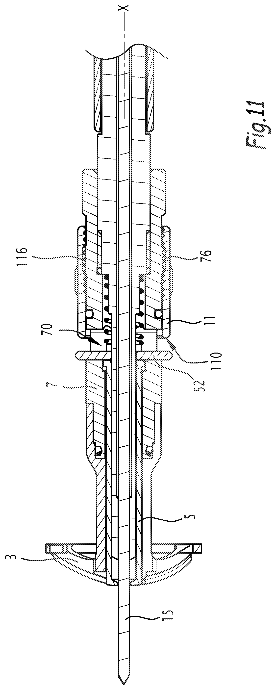 Patent US12137921 Figure 8 – Surgical bone preparation instrument and assembly comprising such an instrument