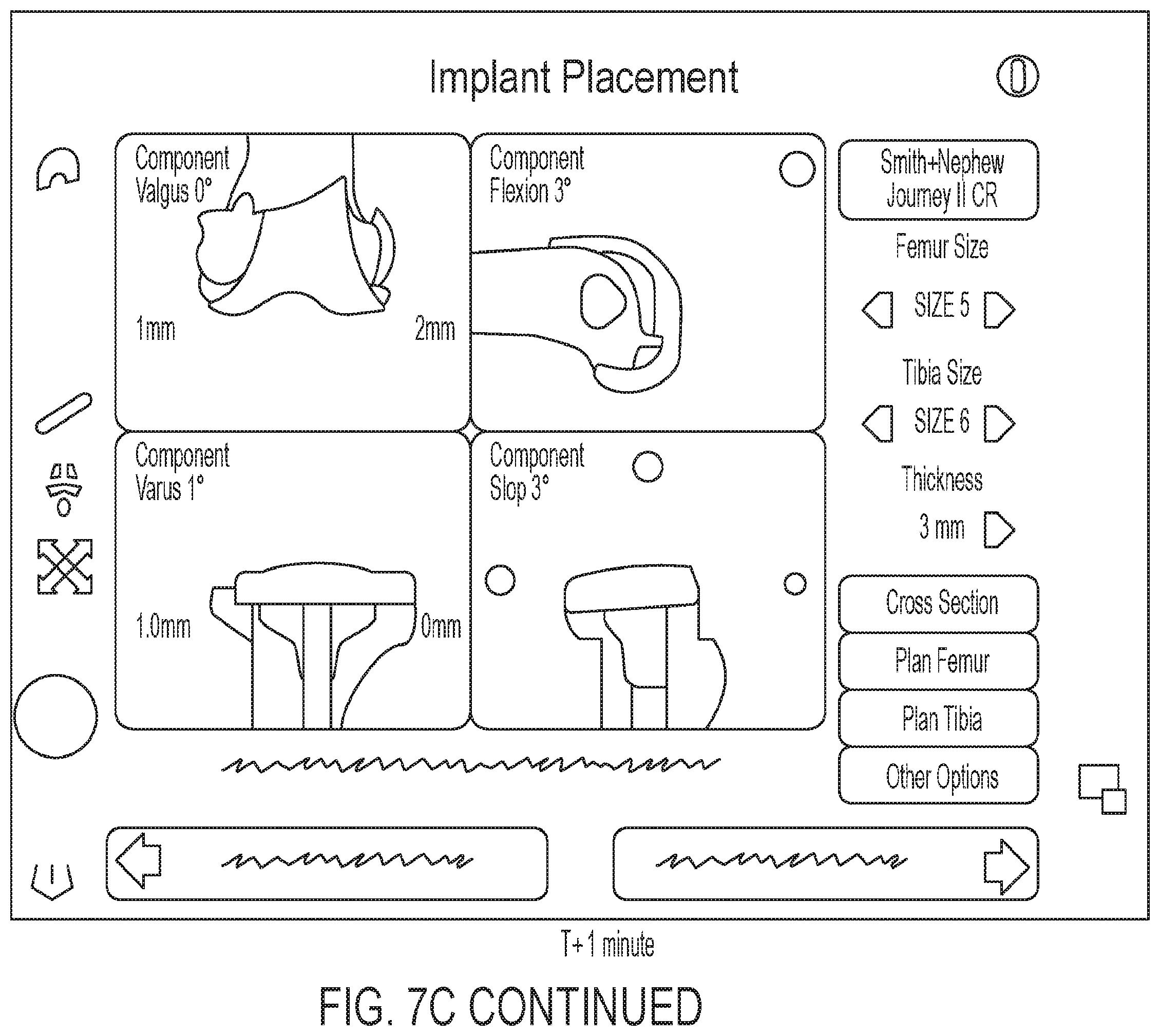 Patent US12137922 Figure 12 – Patient-specific guides for Latarjet procedure