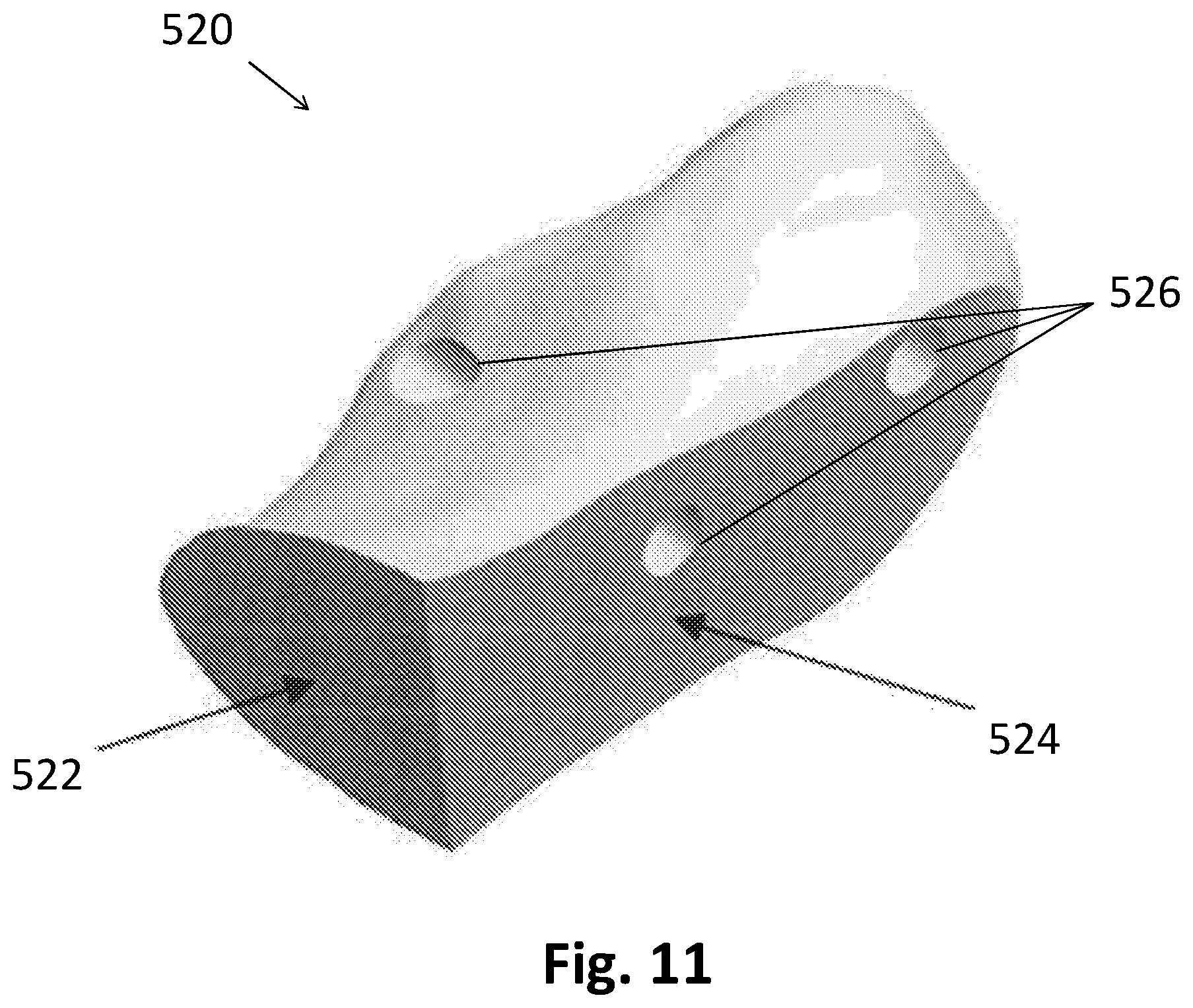 Patent US12137922 Figure 18 – Patient-specific guides for Latarjet procedure