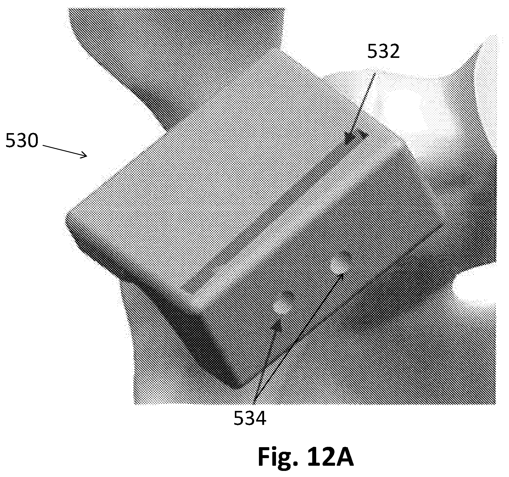 Patent US12137922 Figure 19 – Patient-specific guides for Latarjet procedure