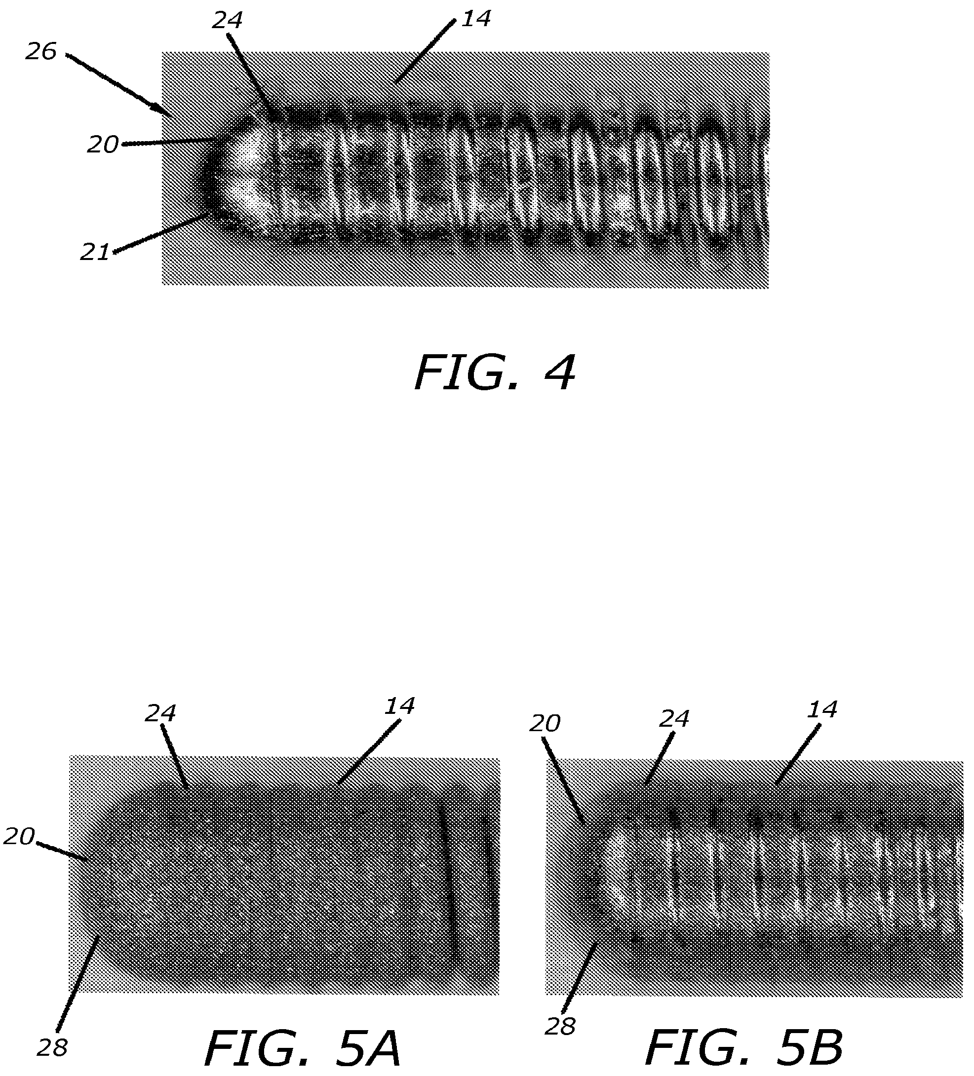 Patent US12137923 Figure 2 – Guide wire tip having roughened surface