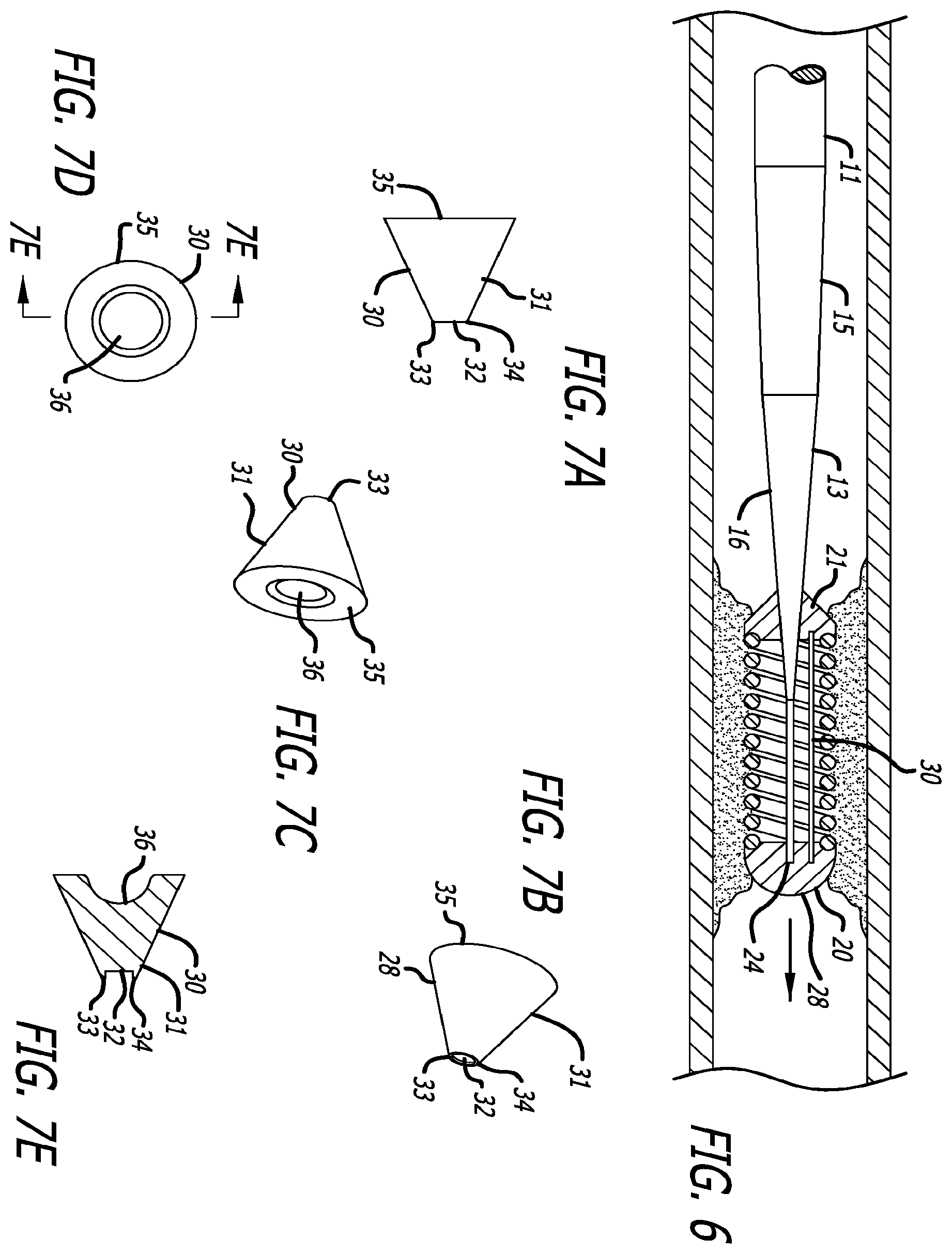 Patent US12137923 Figure 3 – Guide wire tip having roughened surface