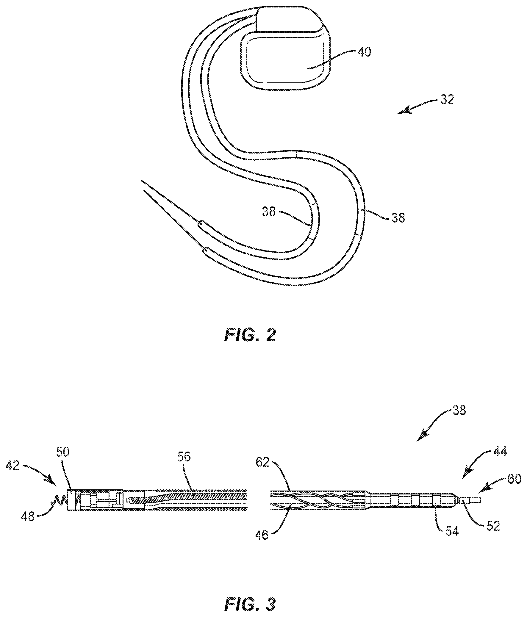 Patent US12137924 Figure 2 – Surgical system and methods