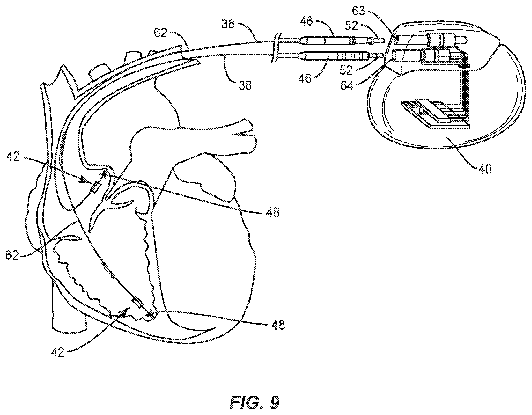 Patent US12137924 Figure 5 – Surgical system and methods