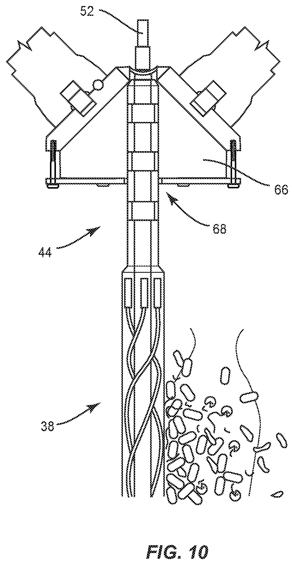 Patent US12137924 Figure 6 – Surgical system and methods