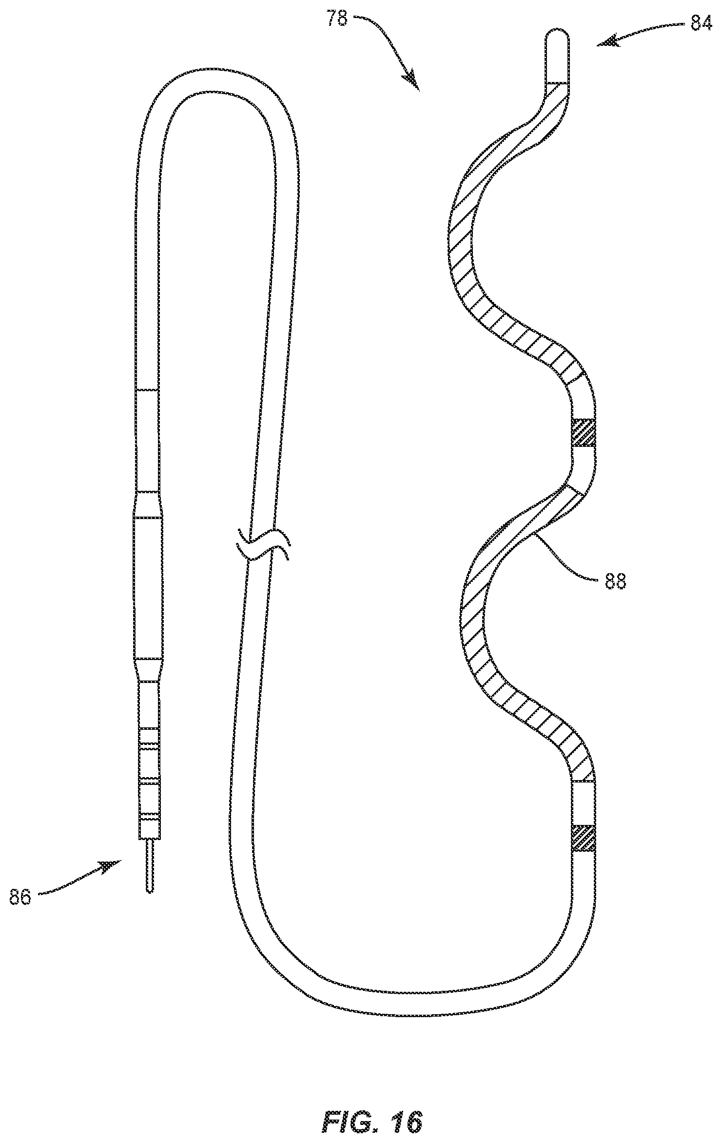 Patent US12137924 Figure 11 – Surgical system and methods