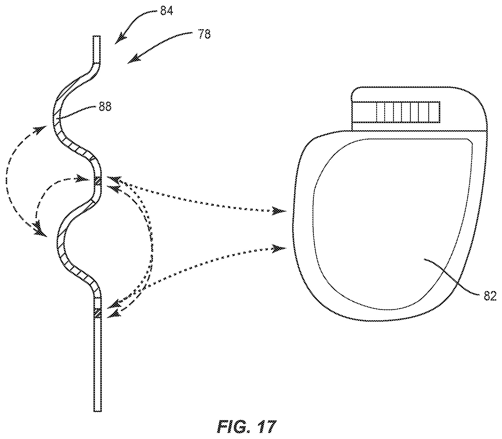 Patent US12137924 Figure 12 – Surgical system and methods