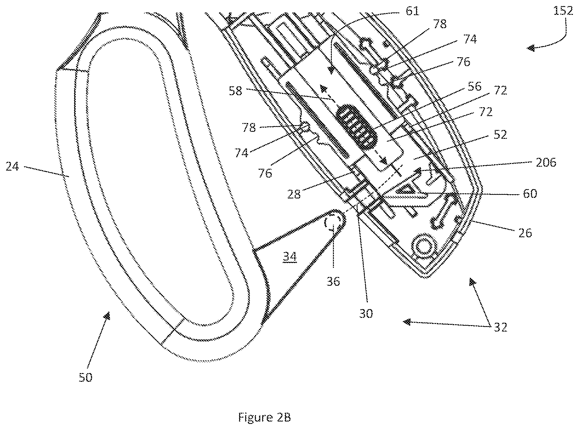 Patent US12137925 Figure 3 – Forceps including a pre-loaded handle latch