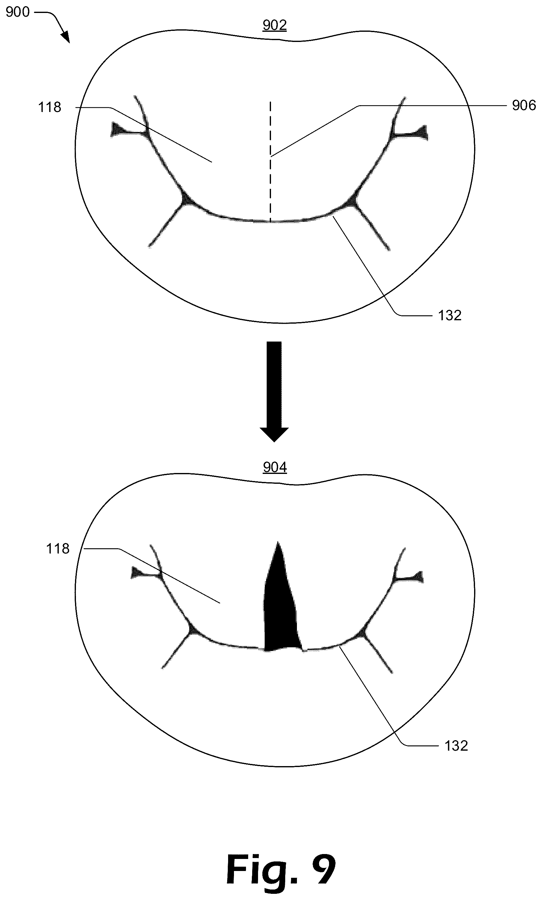 Patent US12137927 Figure 9 – Cutting grasper for valve leaflet laceration