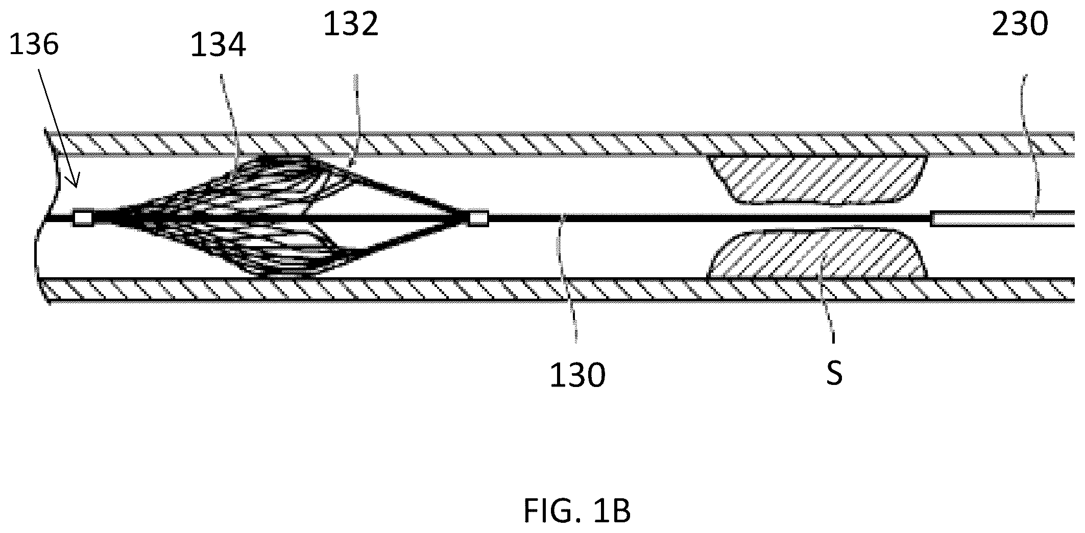 Patent US12137928 Figure 2 – Method and system for controlling rotational speed of an agitator or catheter
