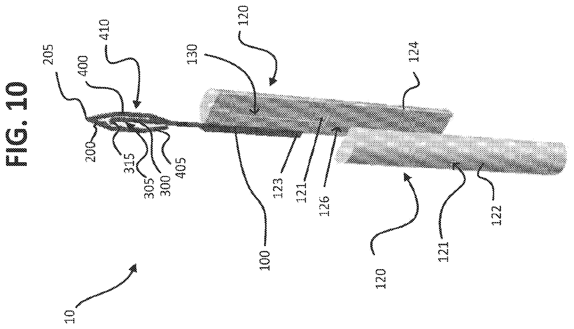 Patent US12137929 Figure 10 – Micro-invasive surgical device and methods of use