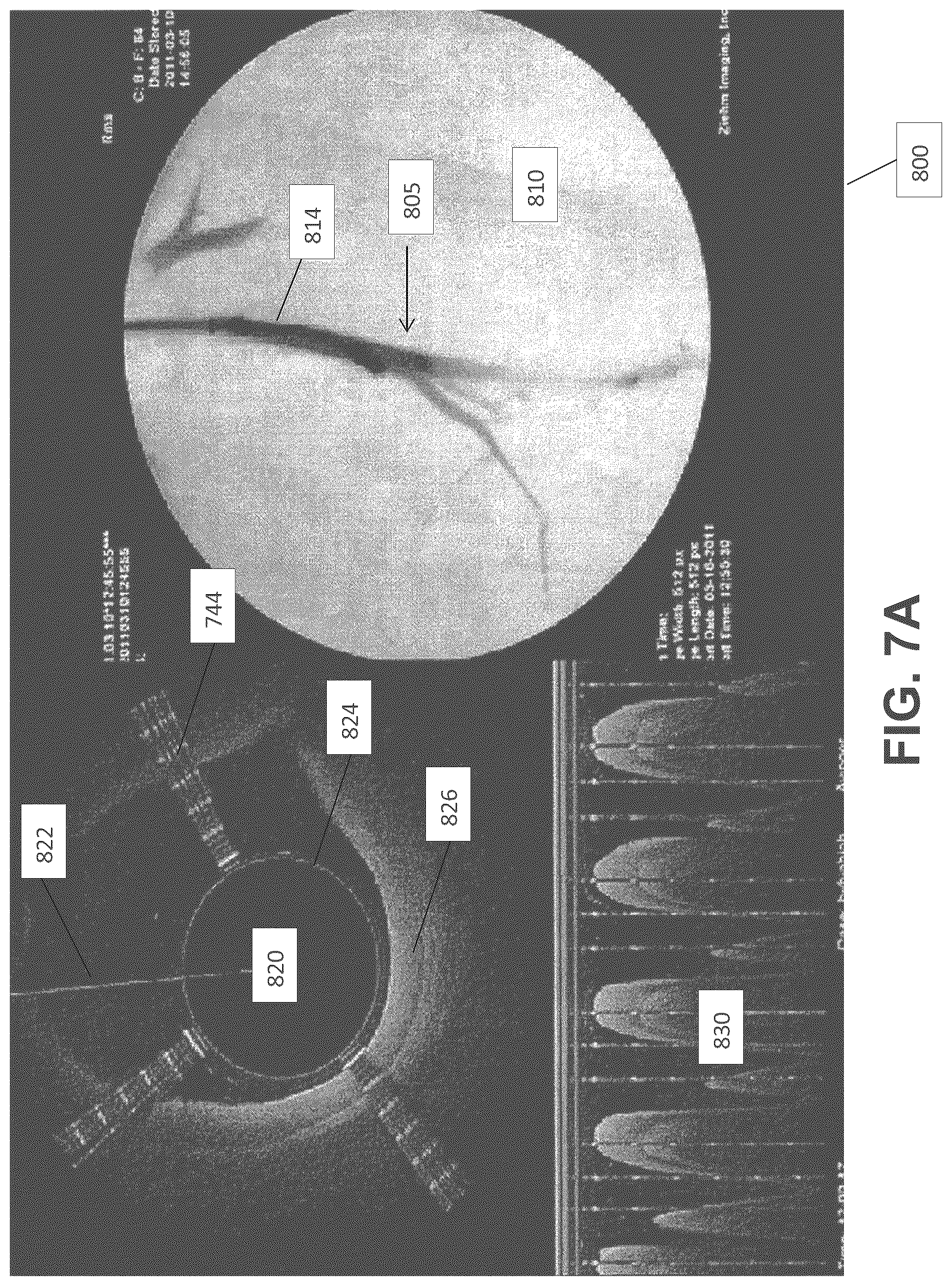 Patent US12137931 Figure 14 – Occlusion-crossing devices